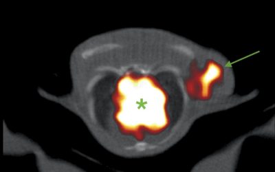 Inmuno-PET, nueva técnica de imagen que podría revolucionar el diagnóstico en cáncer y monitorizar la eficacia de los tratamientos