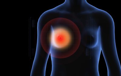 [SABCS 2023] Análisis post hoc del estudio clínico central EMERALD