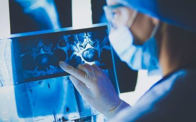 Radiómica, una aliada innovadora en el tratamiento del cáncer